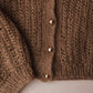 Metal buttons